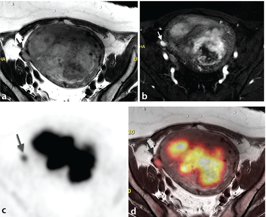 Figure 14