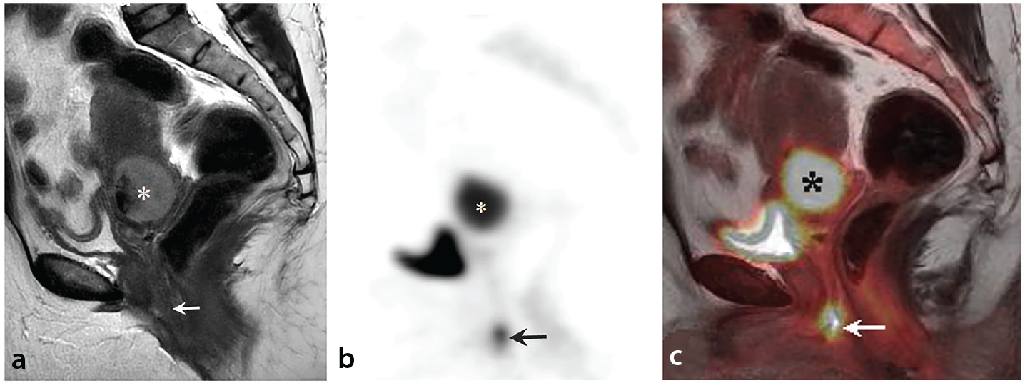 Figure 15