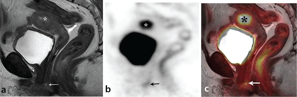 Figure 16