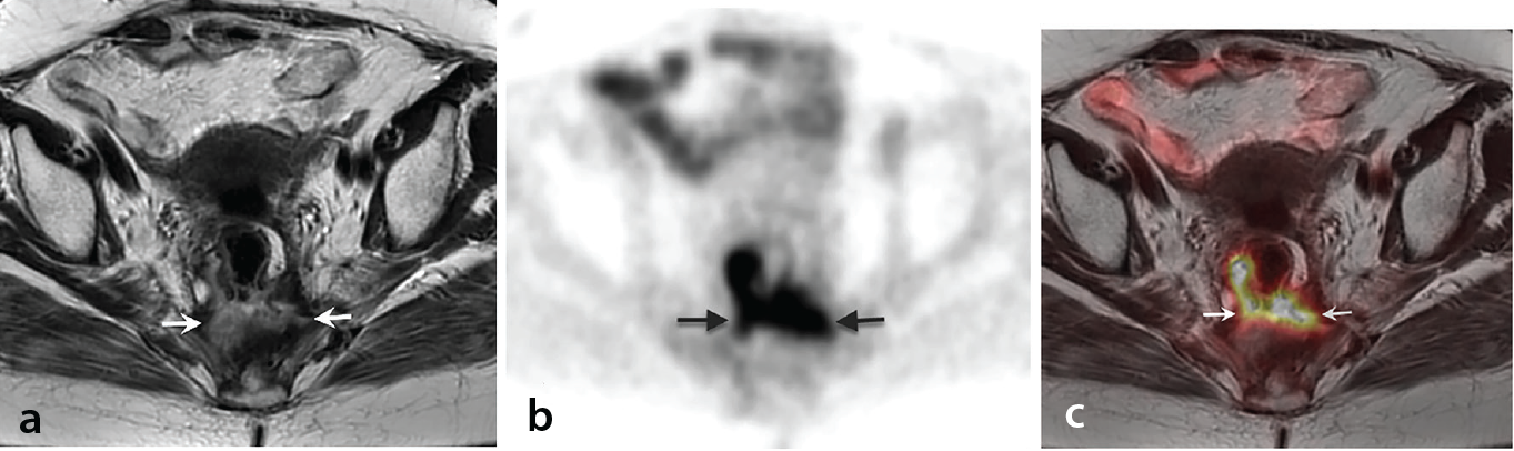 Figure 17