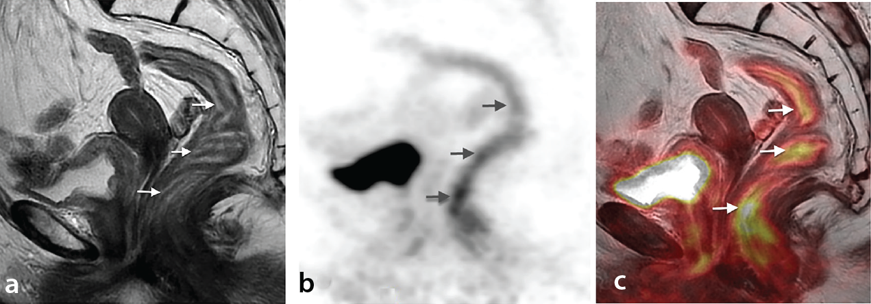 Figure 18