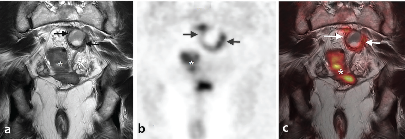 Figure 19