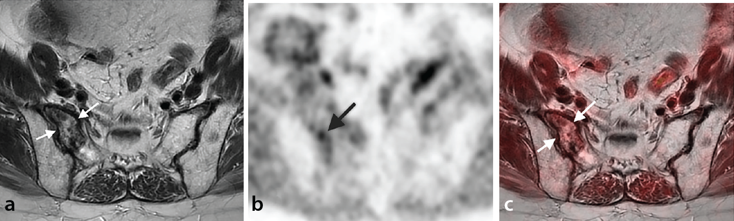 Figure 20