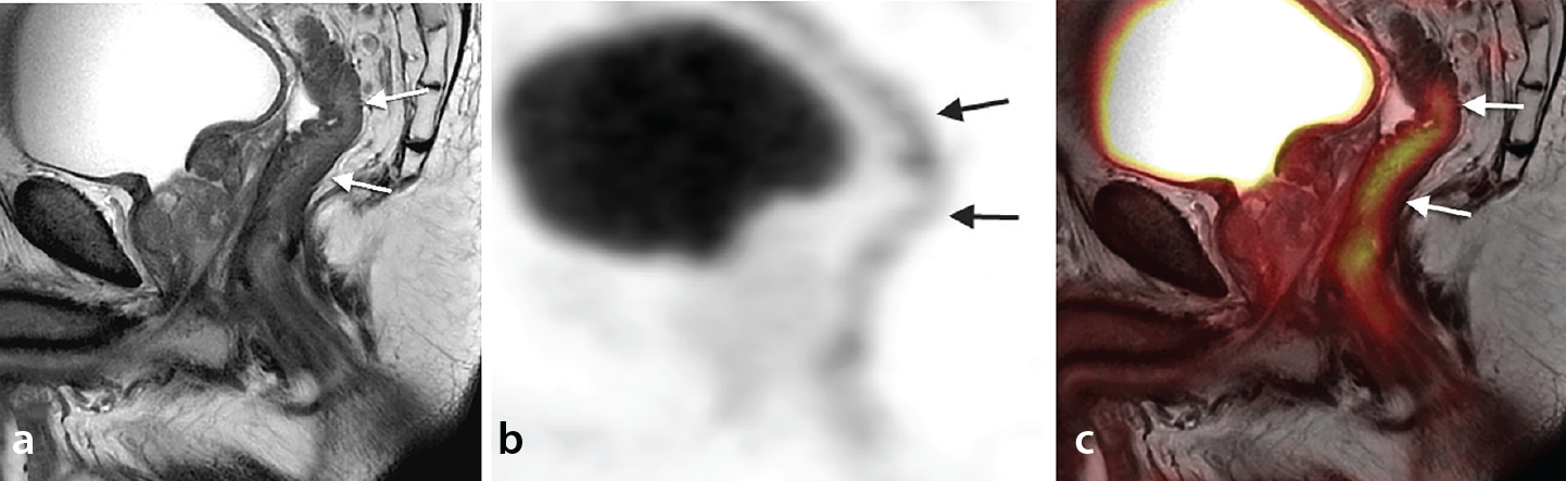 Figure 21