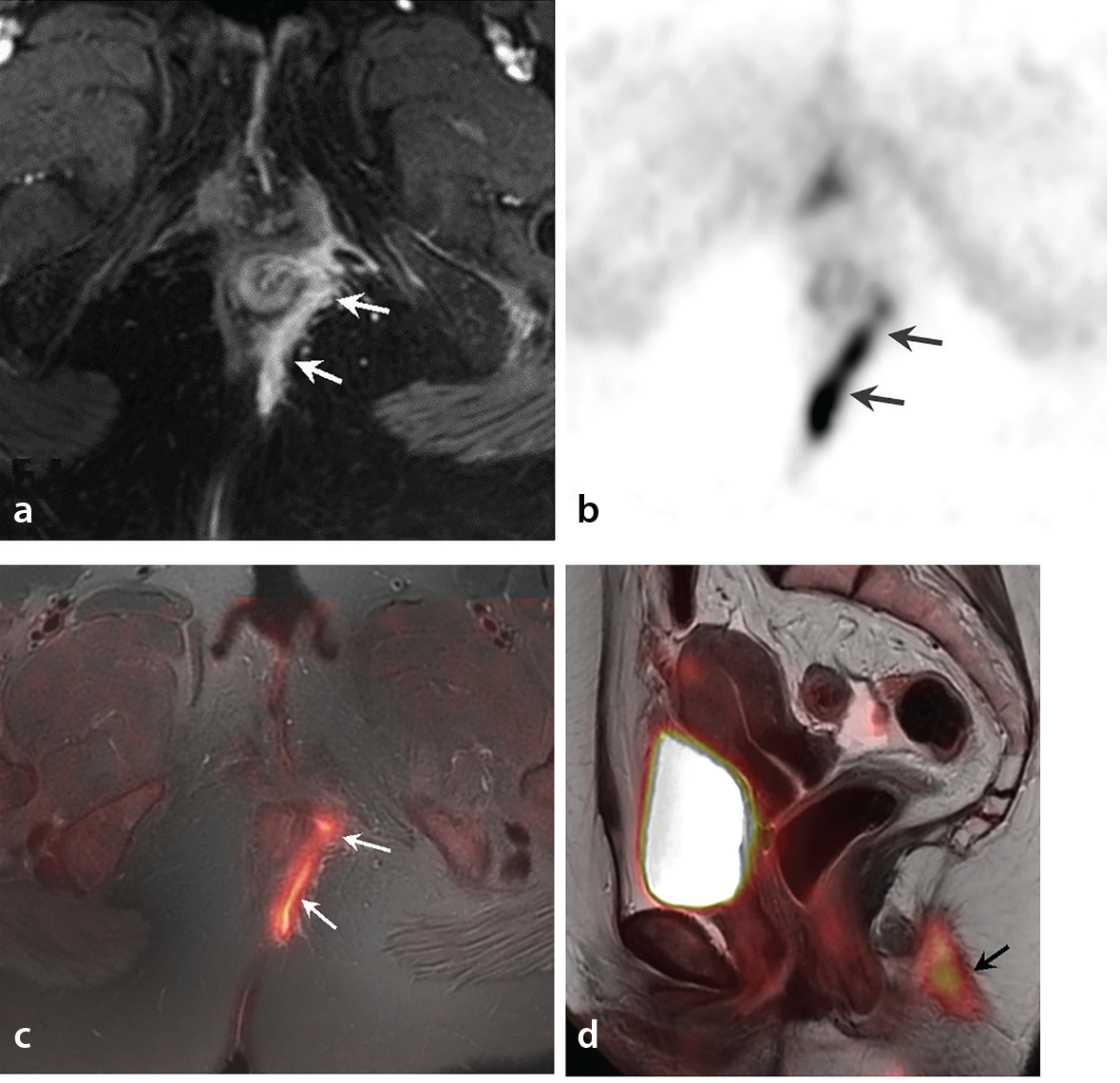 Figure 22