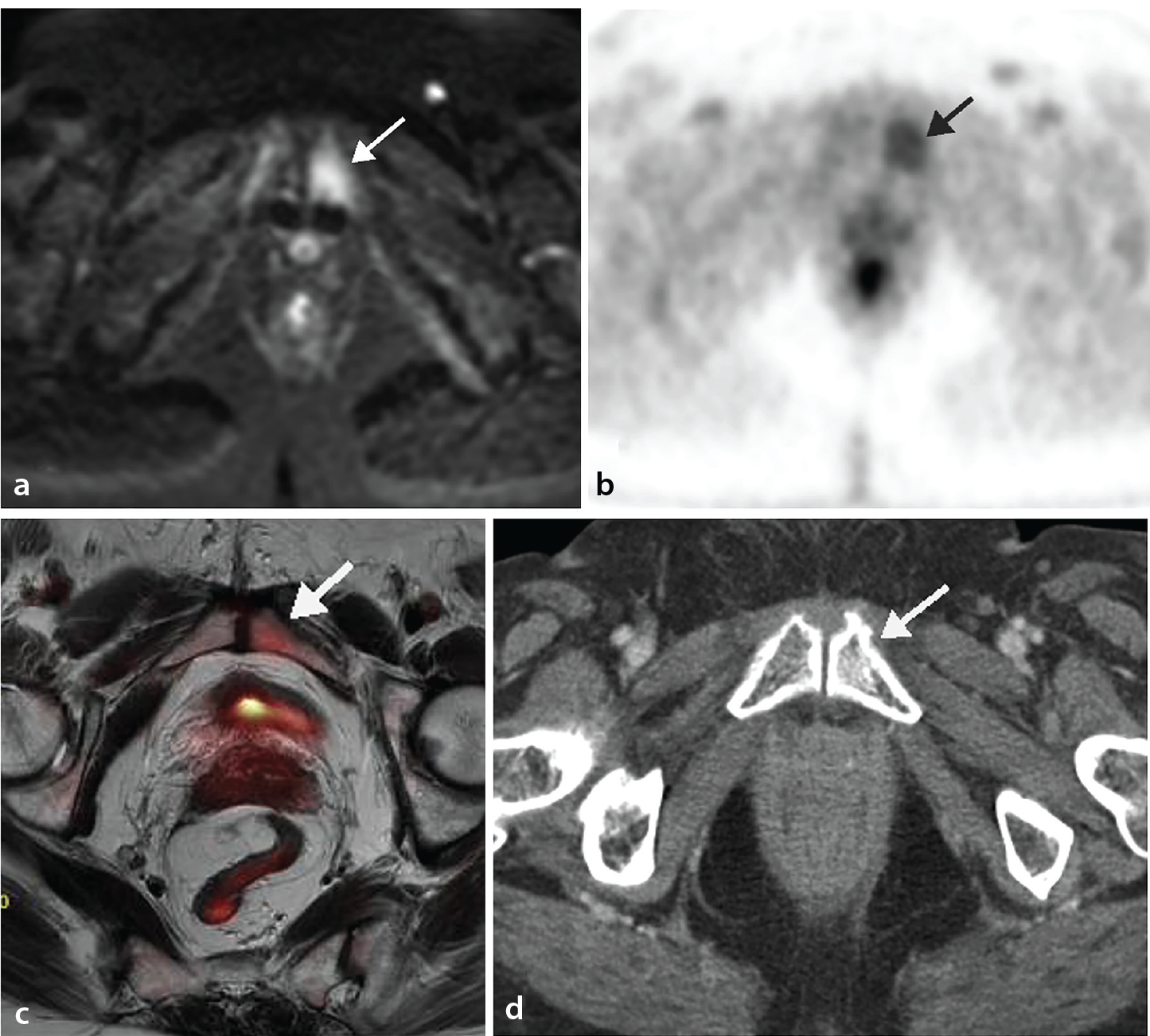 Figure 23