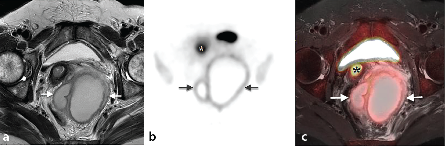 Figure 24