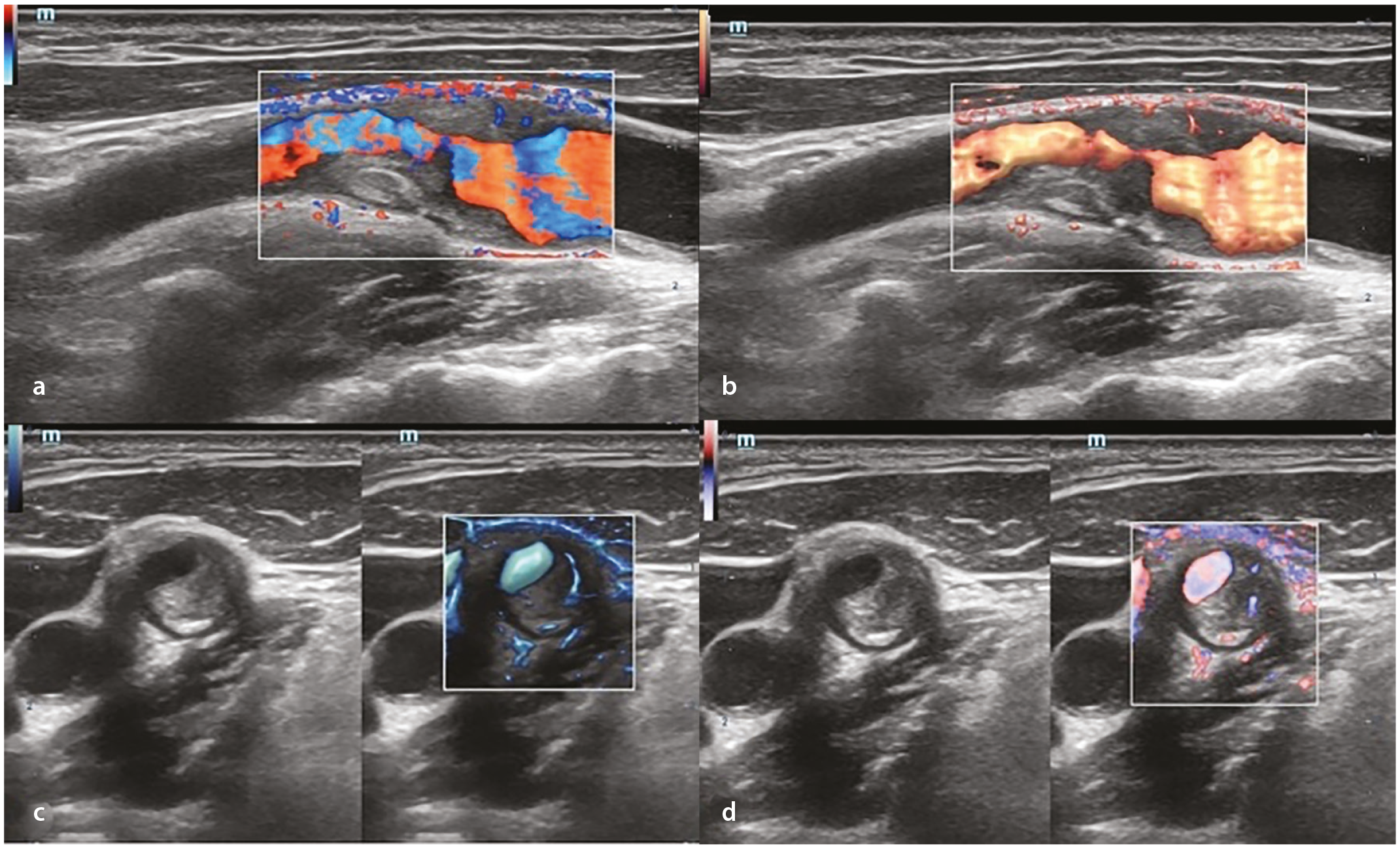 Figure 11