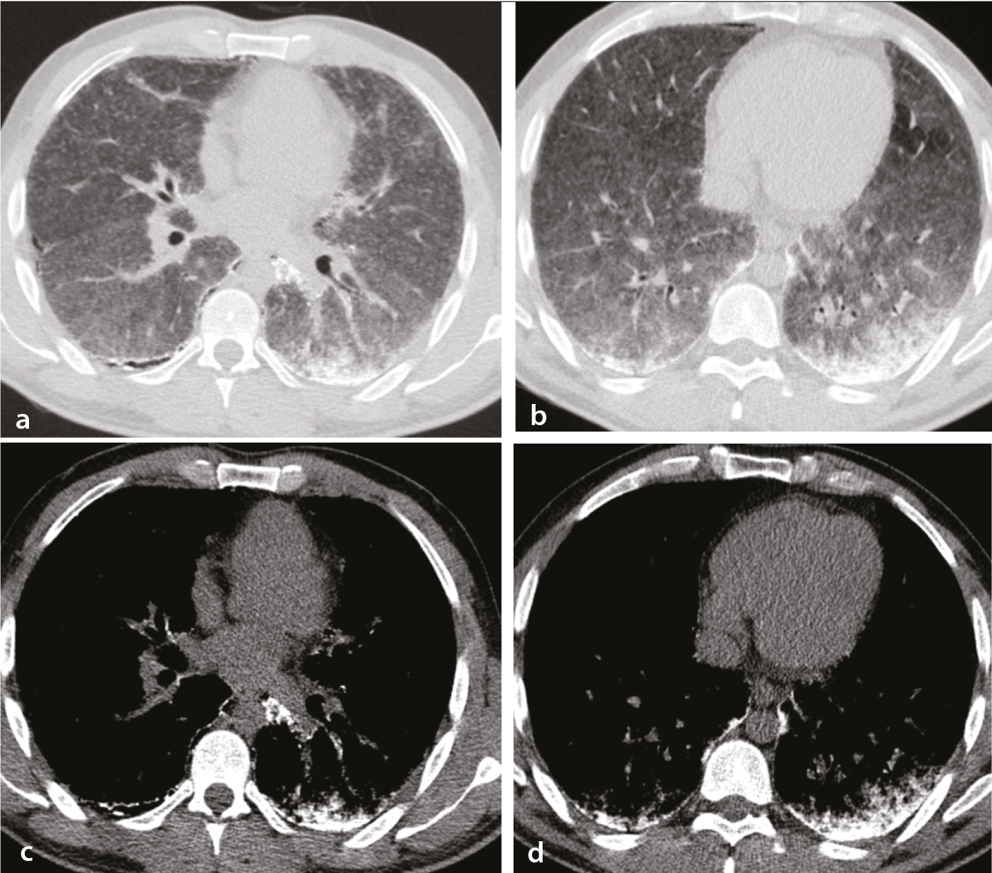 Figure 12