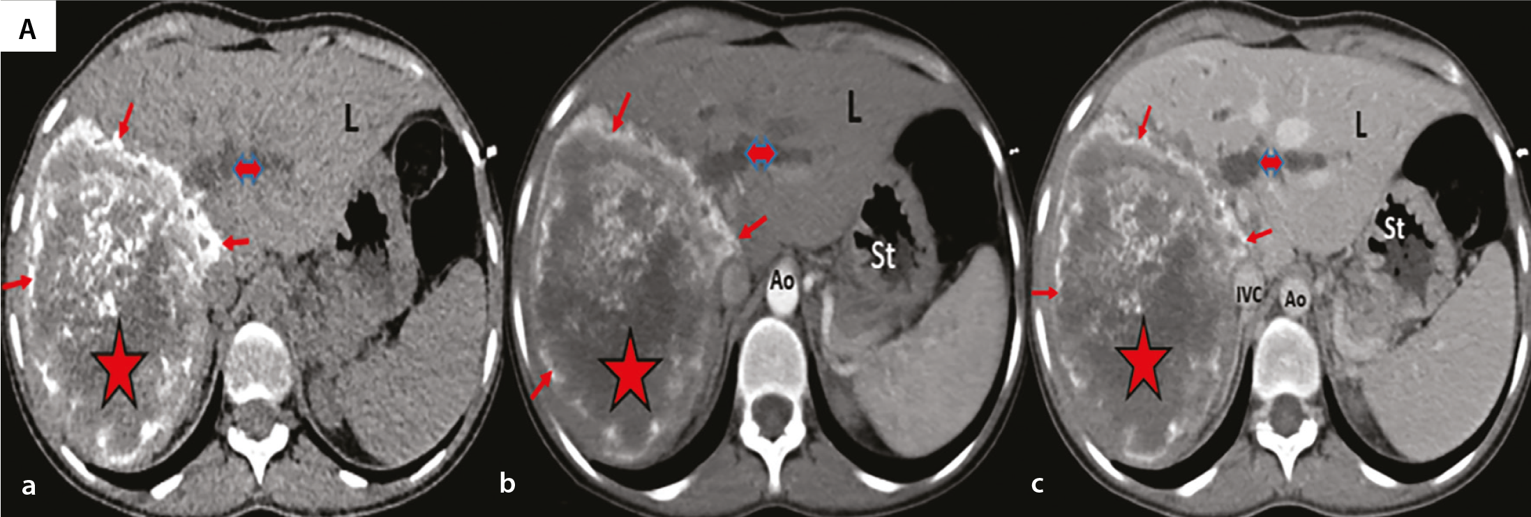 Figure 2a