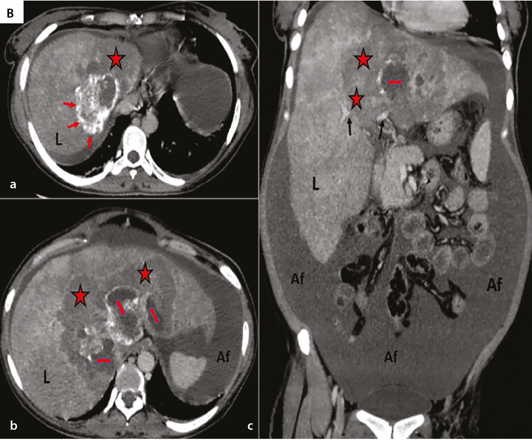 Figure 2b