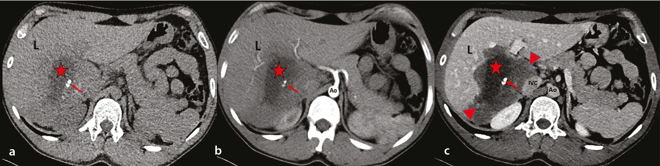 Figure 4a