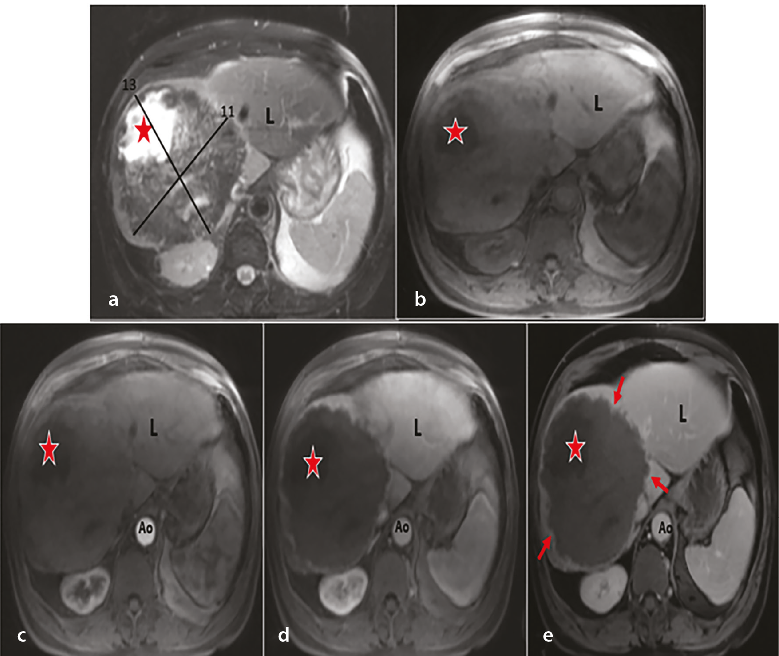 Figure 4b