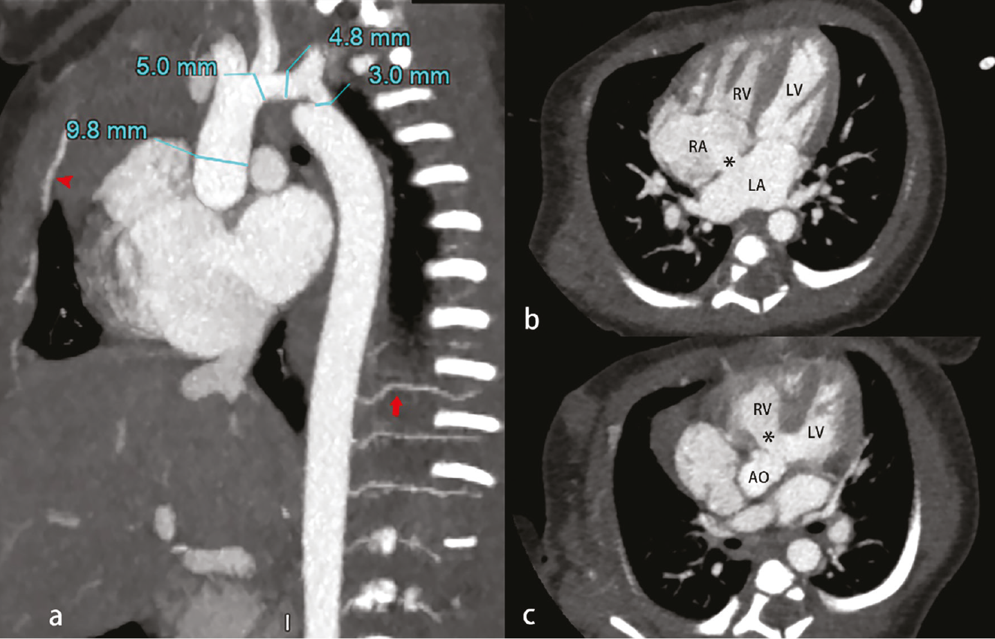 Figure 13