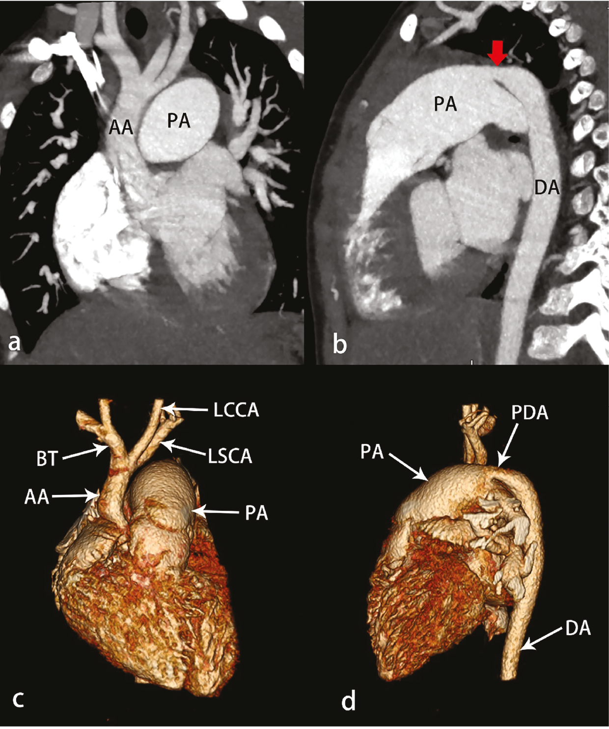 Figure 14
