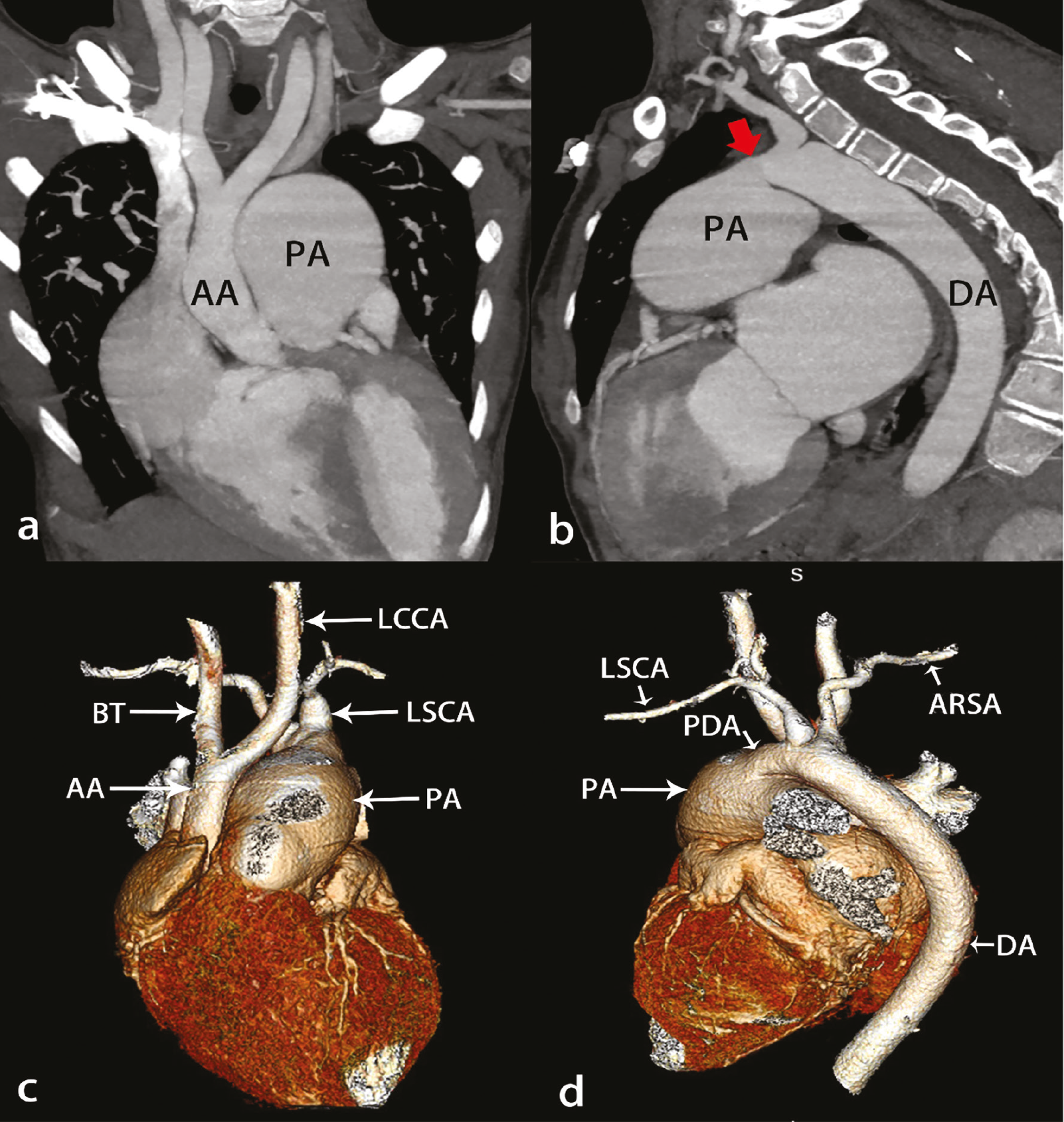 Figure 15
