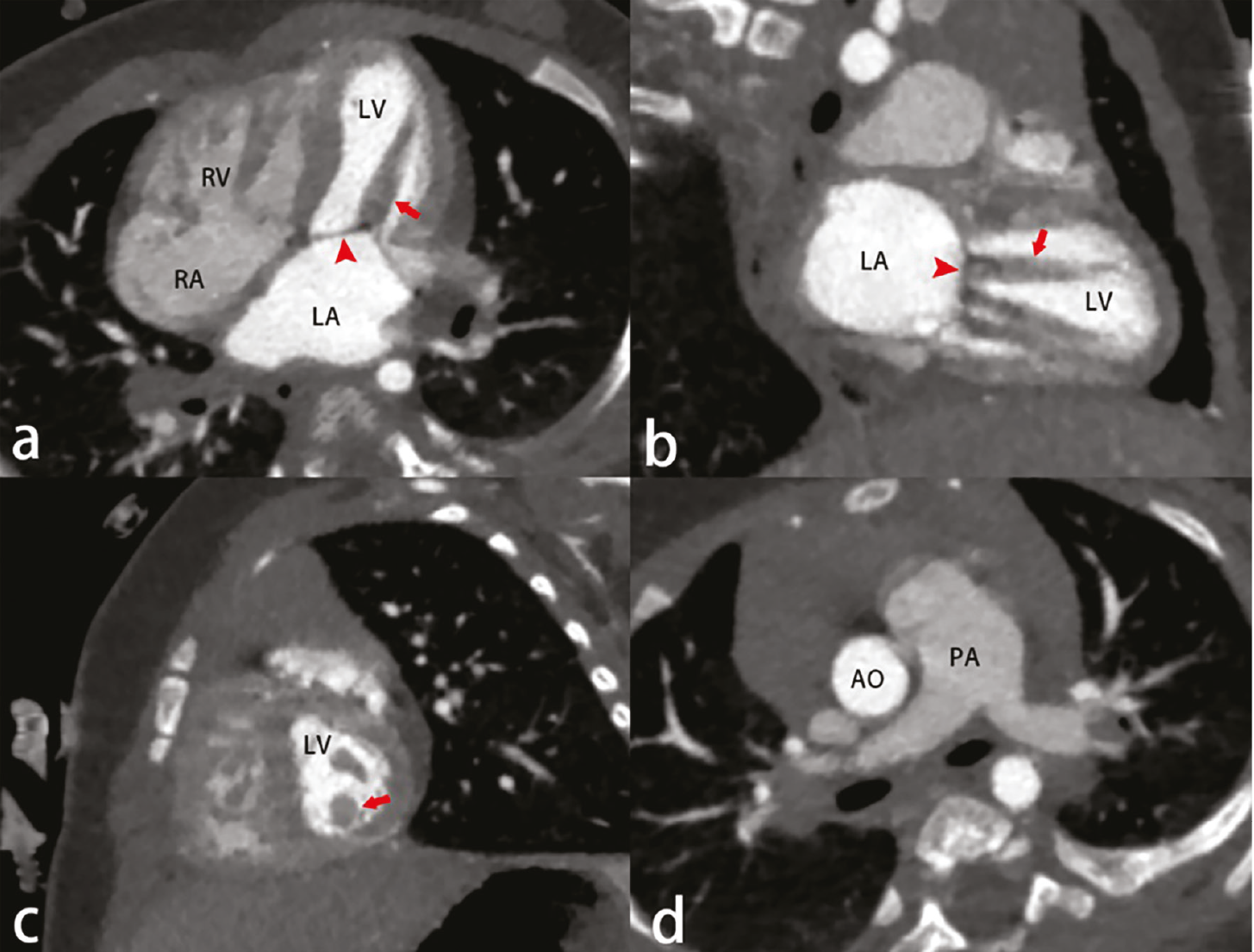Figure 4