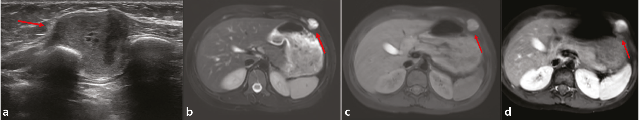 Figure 13