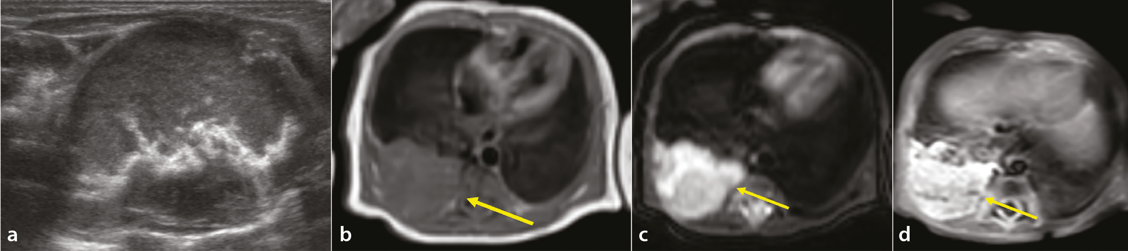 Figure 14